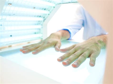 Light Therapy for Psoriasis: Types, Home Therapy, and More