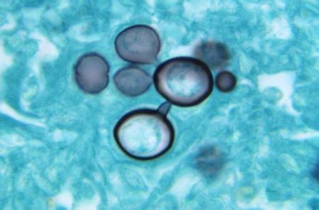 Dimorphic Fungi: Types & Examples | What is Dimorphic Fungi? - Video & Lesson Transcript | Study.com