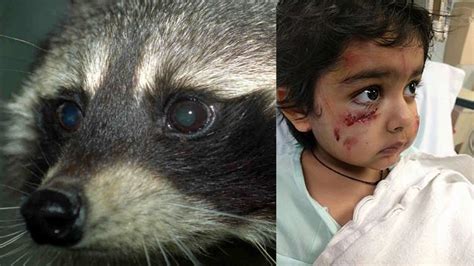 6-year-old boy attacked by raccoon in Elmwood Park, New Jersey - ABC7 New York