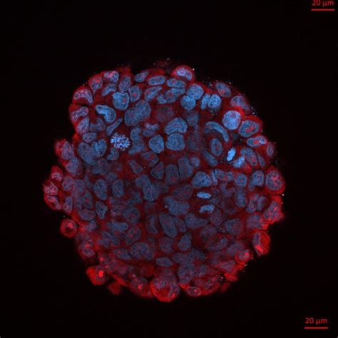 3D Tumor Spheroid Model Showin [IMAGE] | EurekAlert! Science News Releases