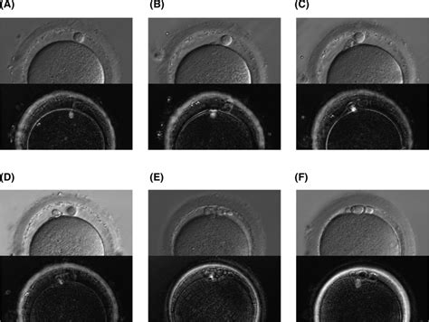 Polar bodies and spindles observed by relief contrast and PolScope. a,... | Download Scientific ...