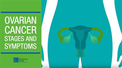 Ovarian Cancer Staging