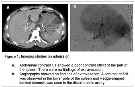 vascular-medicine-surgery-extravasation