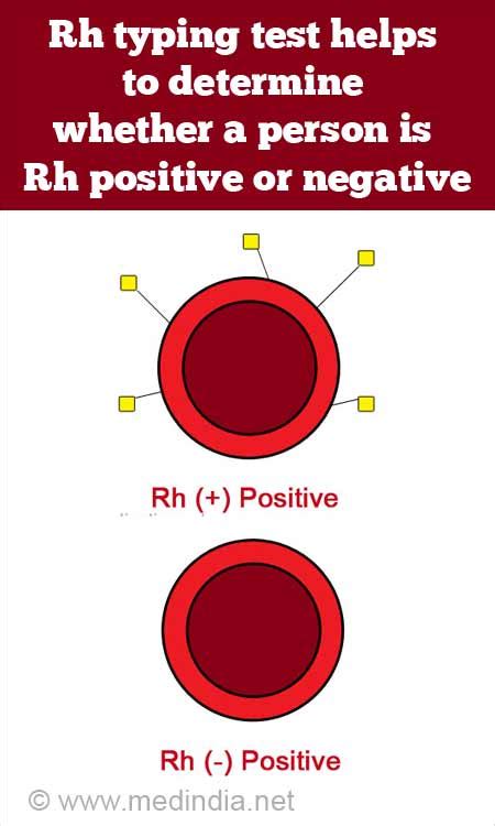 [最も共有された！ √] rh- blood type chart 626712-Blood type chart parents rh factor