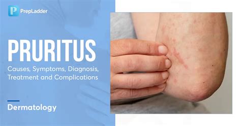 Pruritus: Causes, Symptoms, Diagnosis, Treatment and Complications