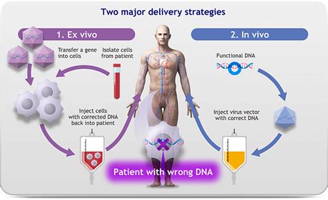 Gene Therapy | Modalis Therapeutics - Official Site