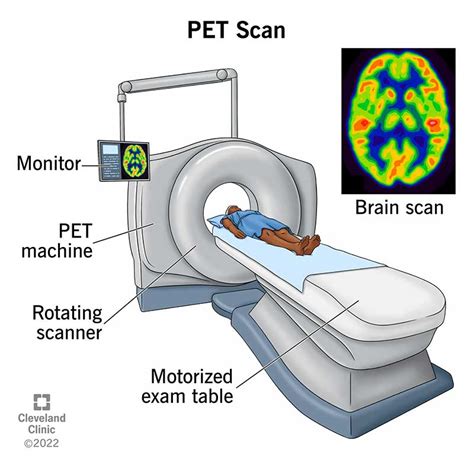 PET Scan: What It Is, Types, Purpose, Procedure & Results