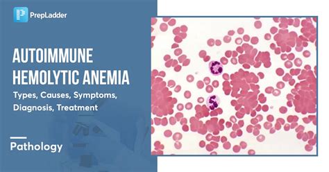 Autoimmune Hemolytic Anemia: Types, Causes, Symptoms, Diagnosis, Treatment