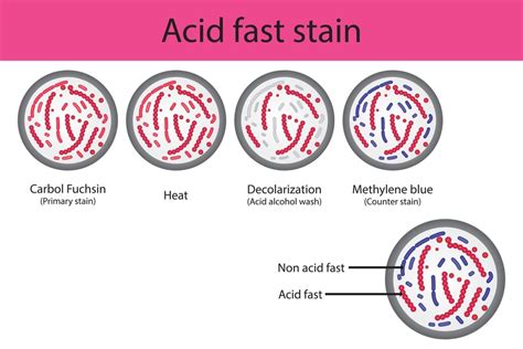 Ziehl Neelsen Stain Acid Fast Staining Test Acid Fast, 53% OFF