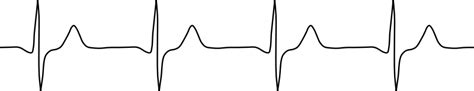 ECG trace - Openclipart