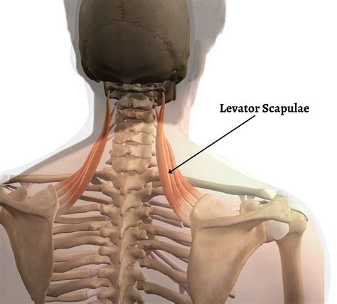 Neck Pain and Levator Scapulae Syndrome