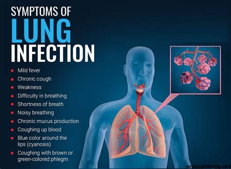 5 Signs and Symptoms of lung infection - My Health Only