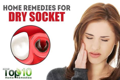 Home Remedies for Dry Socket | Top 10 Home Remedies