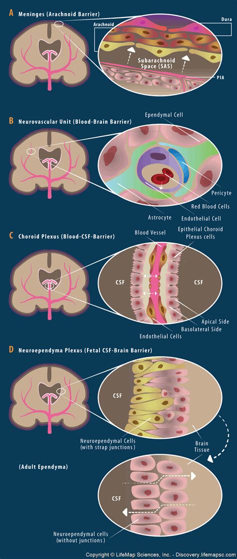 Arachnoid Cyst Symptoms - HRF