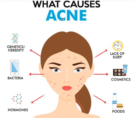 Causes and Treatments for Acne | QuikLaser Skin Treatments Vancouver