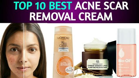 Best Acne Scar Removal Creams in India with prices - YouTube