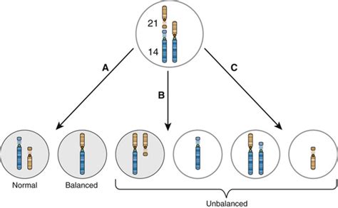 Aneuploidy | Basicmedical Key