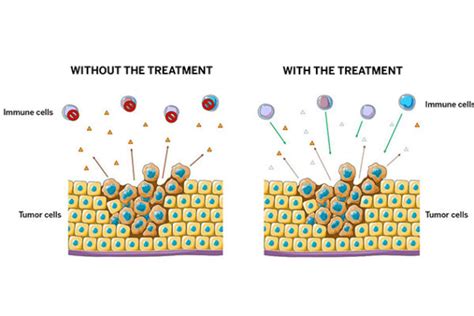 New Cancer Treatment Uses Enzymes to Boost Immune System and Fight Back - UT News