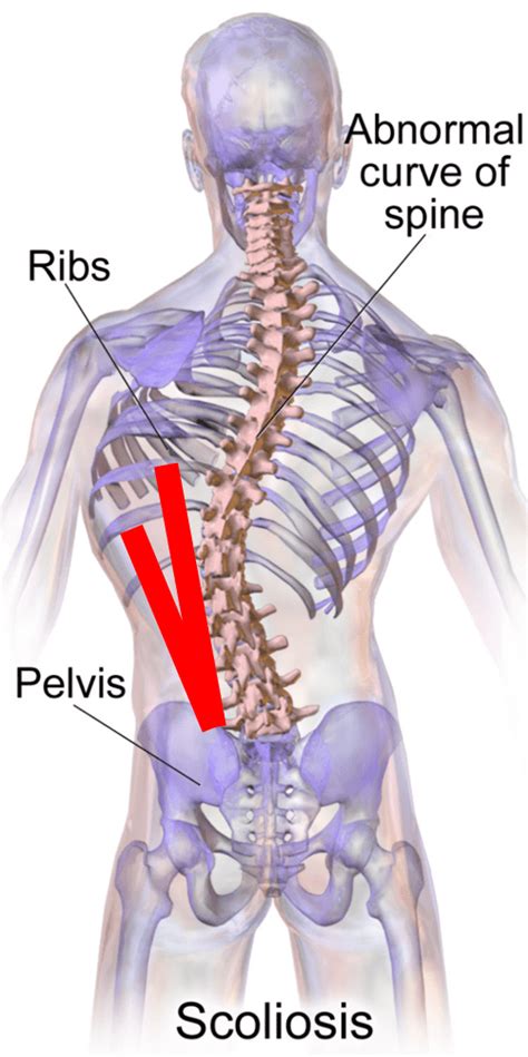 What Causes Back Rib Pain? - Stem Cell Retreats