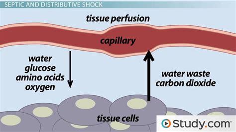 Hypovolemic & Septic Shock | Causes, Symptoms & Treatment - Lesson | Study.com