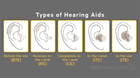 Hearing Aid Repair Cortaro - Oro Valley Audiology