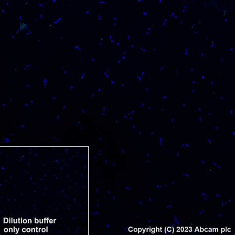 Recombinant Alexa Fluor® 488 Anti-VISTA antibody [EPR21050] (ab314678 ...