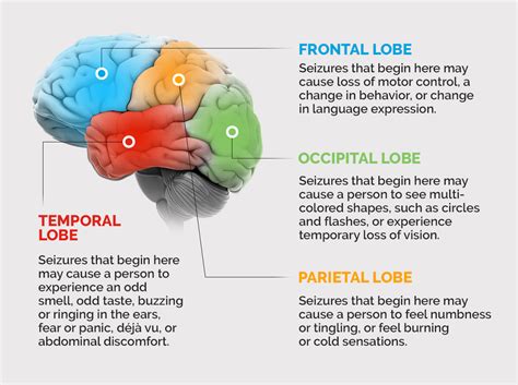 Epilepsy Brain Diagram