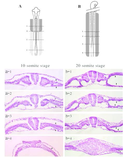 The splitting of the lateral plate mesoderm progresses in an ...