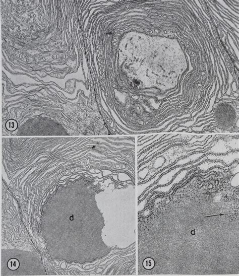 CHANGES IN FINE STRUCTURE DURING SILK PROTEIN PRODUCTION...The Journal of Cell Biology - Dr ...