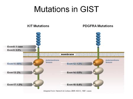 GIST Mutations - Types of GIST Cancer Gene Mutations & Testing | The ...