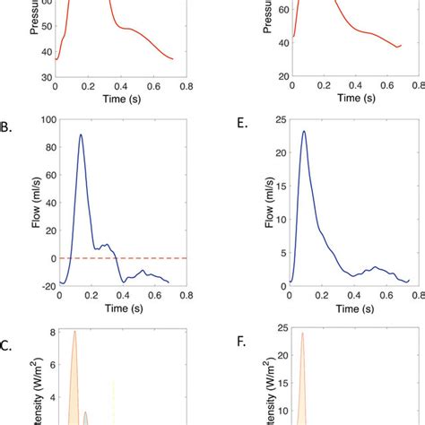 (PDF) A Unified Mechanism for the Water Hammer Pulse and Pulsus Bisferiens in Severe Aortic ...