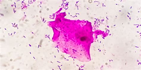 Gram Staining - Principle, Procedure, Purpose & Examples - GeeksforGeeks