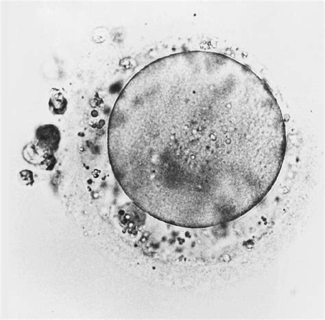 Oocyte with coarse granulation in the perivitelline space (PVS). | Download Scientific Diagram