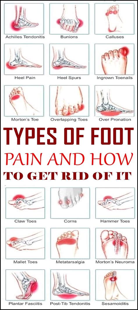 Foot Pain Diagnosis Symptoms Chart