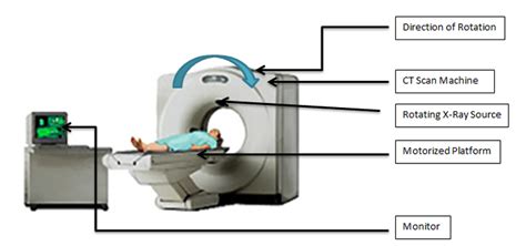 CT Scan Diagram - Computed Tomography Scans