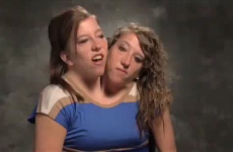 VIDEO: Conjoined twins get their own reality TV show · The Daily Edge