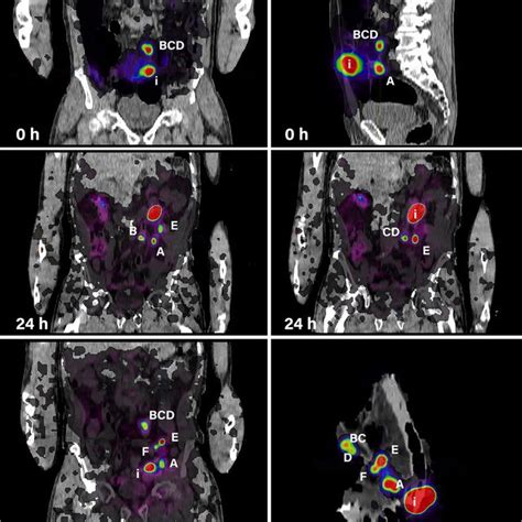 Sentinel lymph node identification by PET/CT imaging over time | Download Scientific Diagram