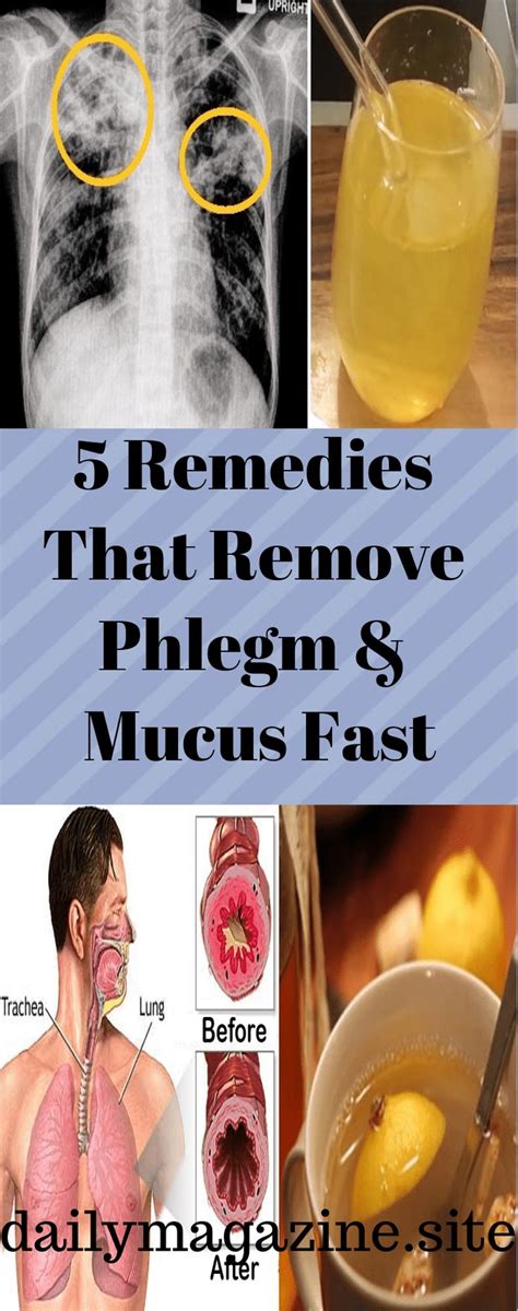 Everyone feels terrible when he has accumulated mucus and phlegm in the nasal passages or in the ...