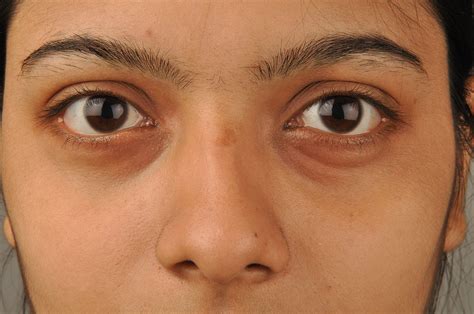 File:Eyes & Nose 5783.JPG - Wikimedia Commons