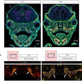 RNAscope Multiplex for in vivo validation of spatiotemporal osteoblast... | Download Scientific ...