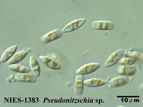 Xenophyophores Size