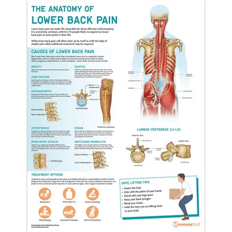 The Anatomy of Lower Back Pain | Low Back Pain | AnatomyStuff