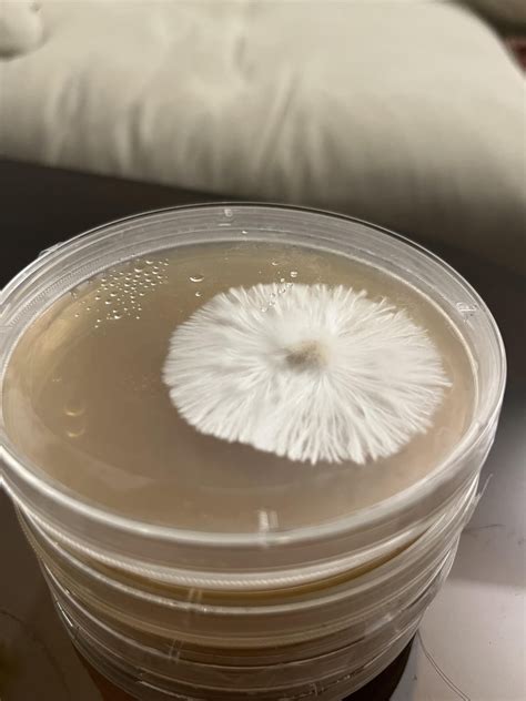 Agar plates are fascinating : r/shroomery