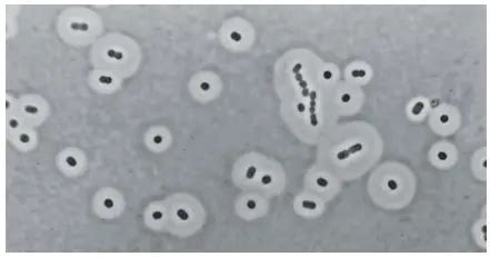 Bacterial Capsule: Importance, Capsulated Bacteria • Microbe Online