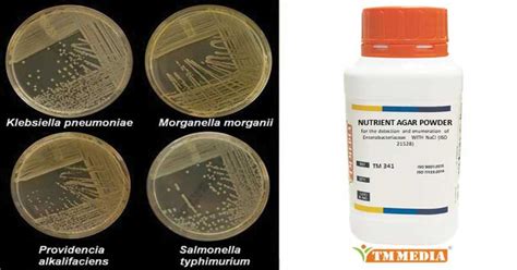 Nutrient Agar- Principle, Composition, Preparation, Results, Uses