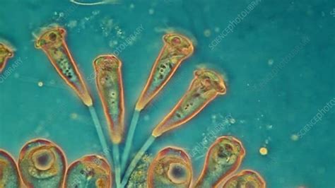 Epistylis ciliates, light microscopy - Stock Video Clip - K005/7395 - Science Photo Library