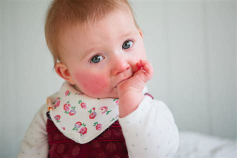 Teething rash: 4 things you need to know