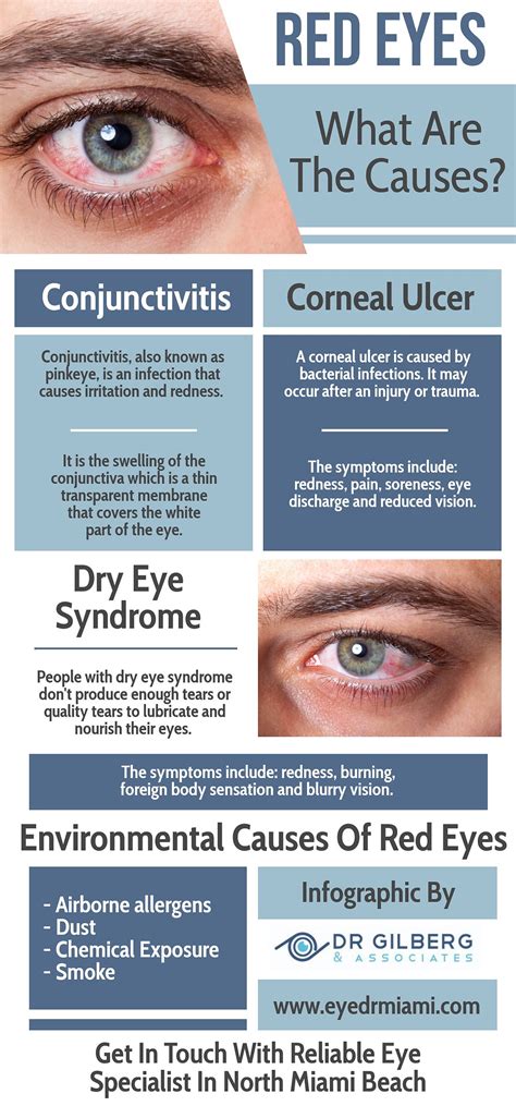 Red Eyes - What are the causes?