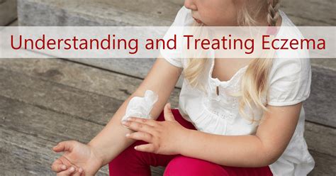 Treating Eczema in Toddlers & Infants | Ask Dr. Sears