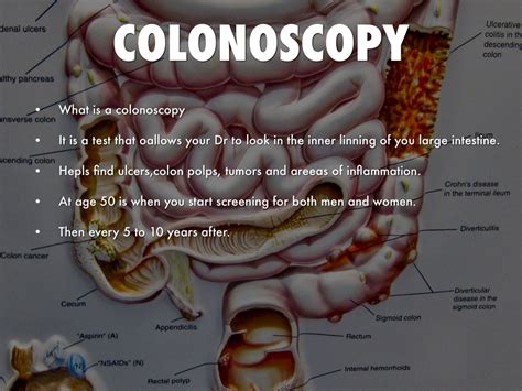 Colonoscopy Age